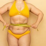 Обвисшая кожа