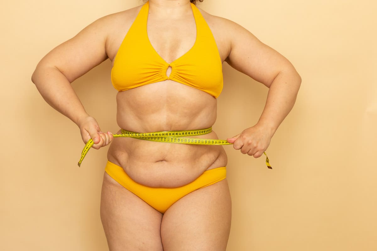 Обвисшая кожа